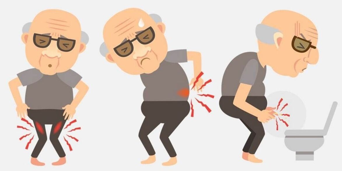 symptoms of prostatitis