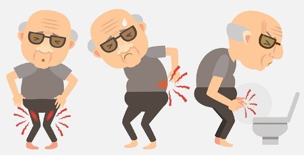 symptoms of prostatitis and its treatment with drugs